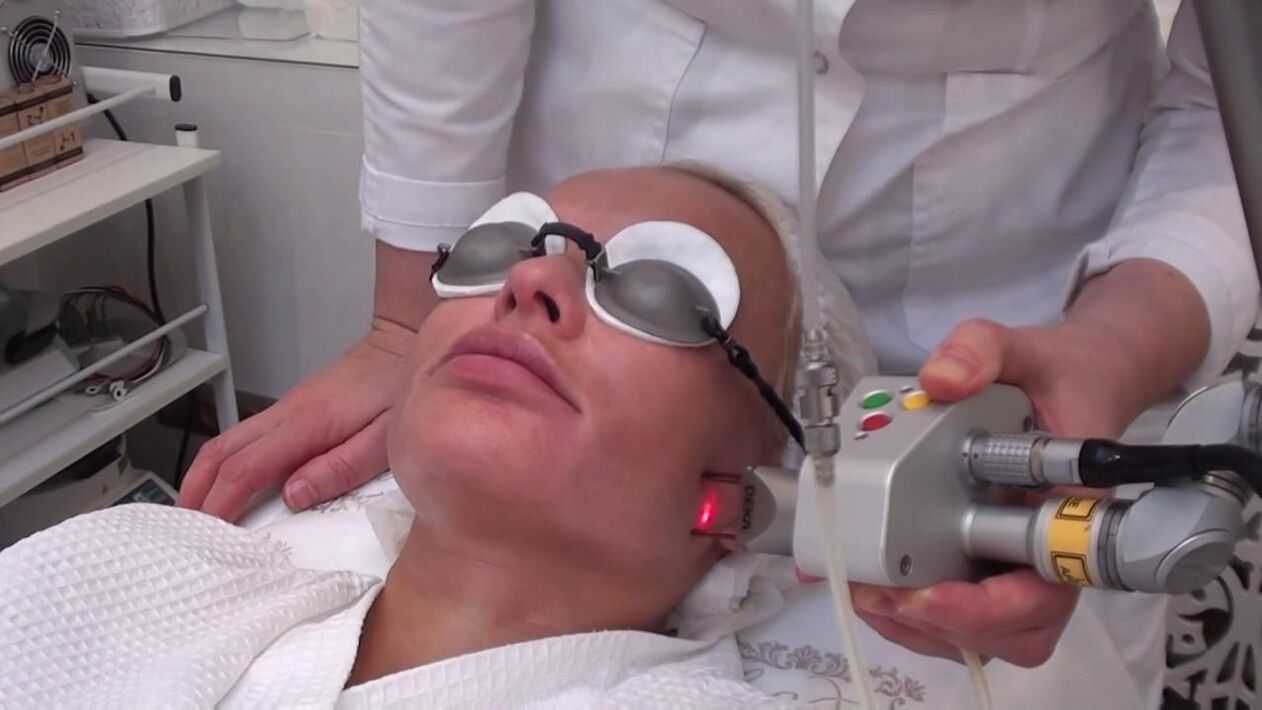 Laser laser treatment of problem areas of human skin