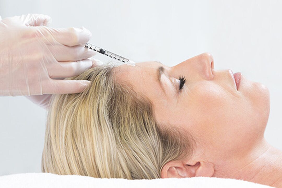 Plasmalifting is an injection method to rejuvenate facial skin